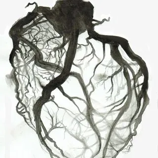 Endovascular.team - рентгенхирургия просто