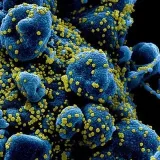 Viral infections -CoronavirusEbola