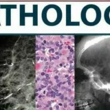 Pathology.1 - pathology of Telegram