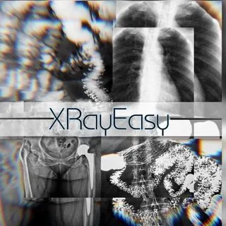 XRayEasy - Рентген простыми словами