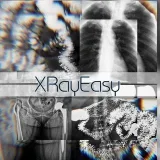 XRayEasy- X-rays in simple words.
