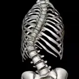 All About Scoliosis - Gymnastics Schrot