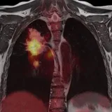 Onco Tweet - Oncología