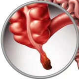 ¿Qué pasa si la apendicitis es un bot?